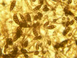 Alternaria alternata conidiën