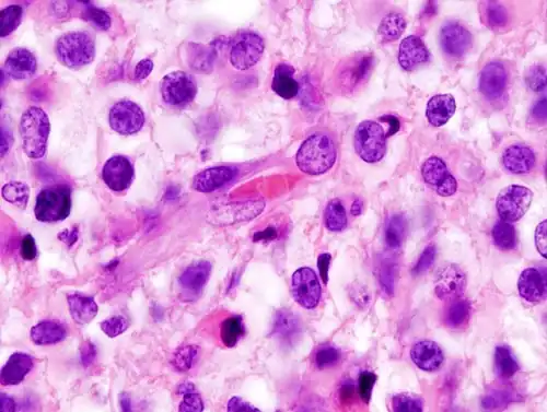 Let bij het inzoomen op de onregelmatige vormen van cellen en kernen.