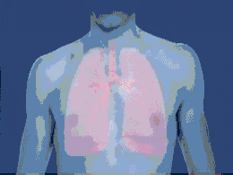 Animatie van een astma-aanval