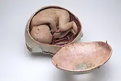 Auzoux zwangerschapsmodel van papier-maché