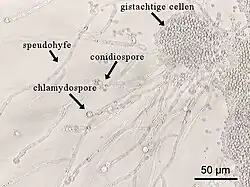Chlamydospore van de gist Candida albicans