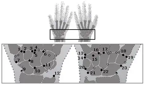 De lokalisaties van de accessoire handwortelbeentjes.Links de rechterhand van dorsaal, rechts vanaf palmair.