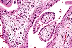 Chorionvilli zeer sterke vergroting. (H&E-kleuring)