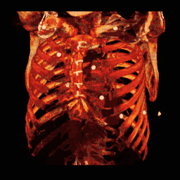 3D VR van een CT-scan