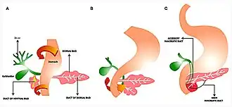(A) Rotatie van de ventrale knop met de maag en de twaalfvingerige darm naar rechts. (B) De ventrale en dorsale knop fuseren. (C) De hoofdgang van de alvleesklier die via de ventrale knop naar de twaalfvingerige darm gaat. De ventrale knop vormt de processus uncinatus pancreatis en een deel van de kop van de alvleesklier. De dorsale knop vormt de rest van de alvleesklier.