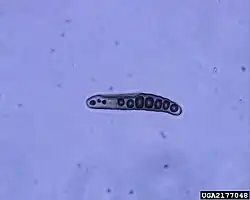 Sporenzakje van geslachtelijke fase