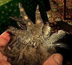 Voet met polydactylie