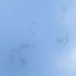 Impressie van 'drijvers' in een oog