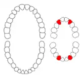 Laterale melksnijtand
