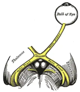 De linker nervus opticus, het chiasma opticum en de tractus opticus