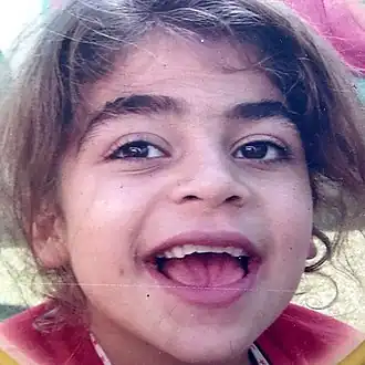 Ziekte van Sanfilippo