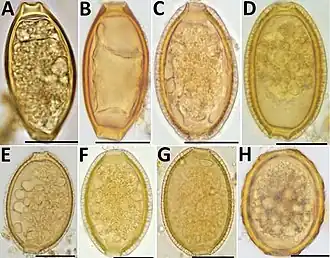 C t/m G: Eieren van Capillaria sp.