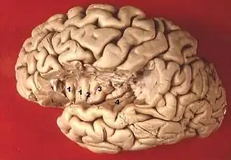 alt=Linkergrotehersenhelft. Deel dat dat gewoonlijk het eiland van Reil bedekt, is verwijderd.
1. Gyri breves insulae, 2. Sulcus centralis insulae, 3. Gyrus longus insulae, 4. Gyri temporales transversi.