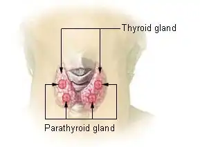 Hyperparathyreoïdie