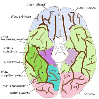 Onderaanzicht van de grote hersenen (boven: voorkant, onder: achterkant). De sulcus occipitotemporalis is aangegeven als sillon occipito-temporal.