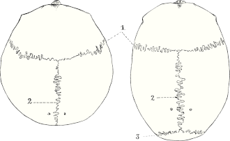 bovenaanzicht van het schedeldak