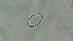 Ascospore van Lecanora pulicaris