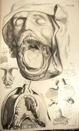 Schets van de mondholte uit Chirurgie et Médecine  Ambroise Paré, 1652