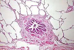 Coupe van het longweefsel. In het midden een bronchiole met daaromheen alveoli