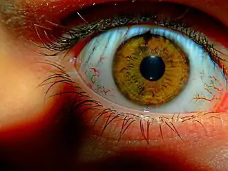 Paranoïde persoonlijkheidsstoornis