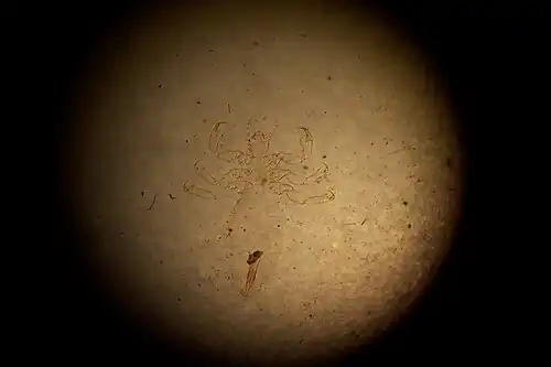 Hoofdluis onder de lichtmicroscoop