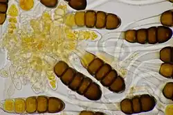 Telium met teliosporen op viltganzerik