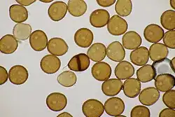 Urediniosporen en een teliospore