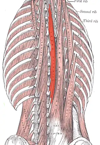 diepe spieren van de rug. (musculus spinalis thoracis is te zien in het midden, de andere musculi spinales zijn niet zichtbaar.)