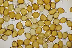 Wanden van de teliosporen