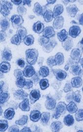 Xenotropic murine leukemia virus-related virus